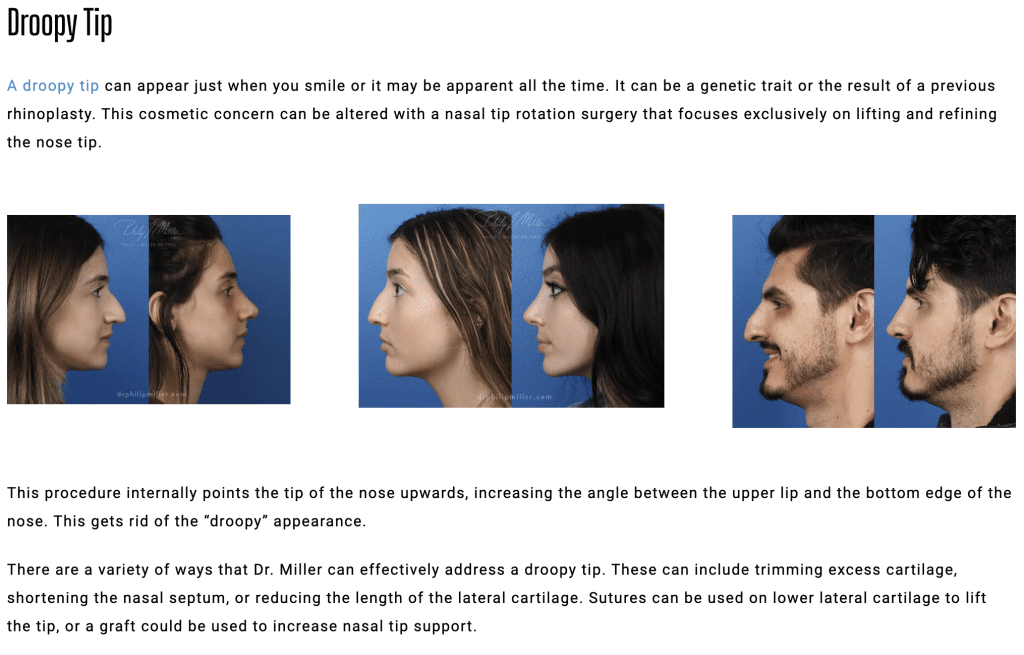 How Rhinoplasty (nose job) works?